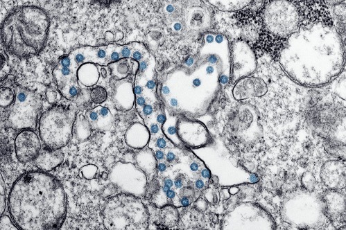 Unlocking the Power of Diversity in the Immune System - Image 1